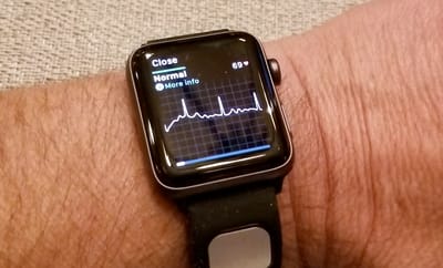 Heart-Healthy Wearables? Believe It